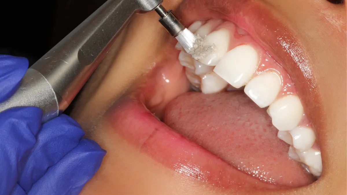 precio diseño de sonrisa en peru