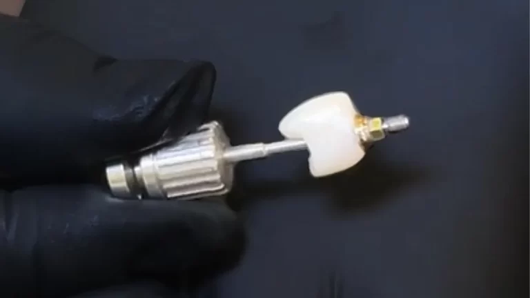 Precio de una corona dental en Perú