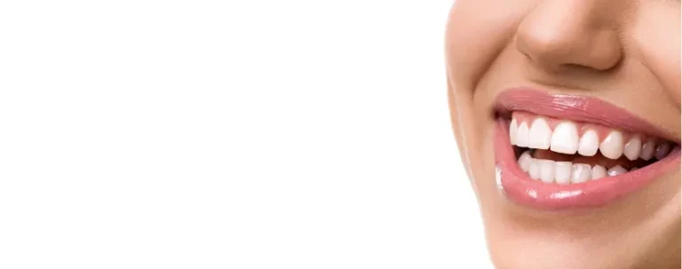 cómo blanquear los dientes