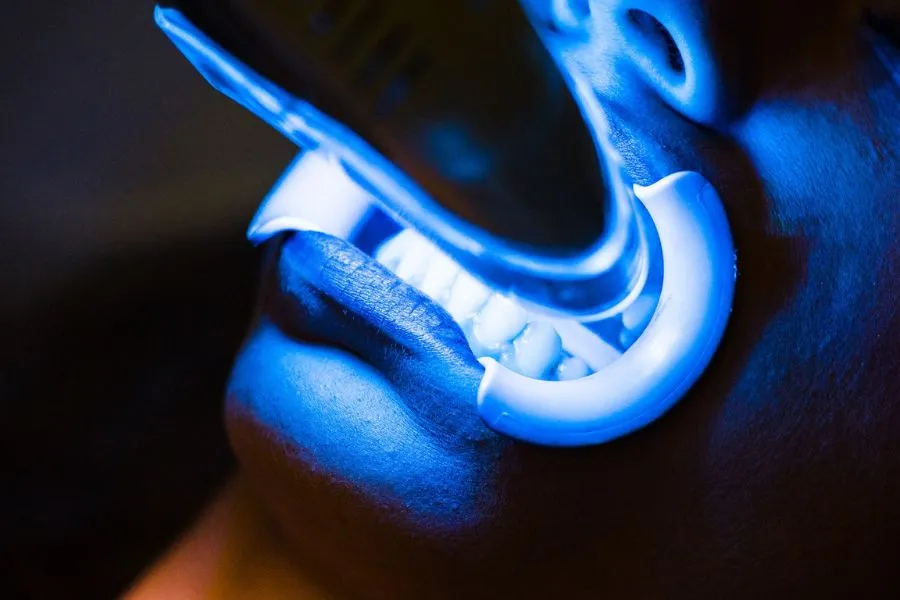 professional-teeth-whitening-gel