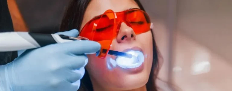 blanqueamiento-dental-con-gel