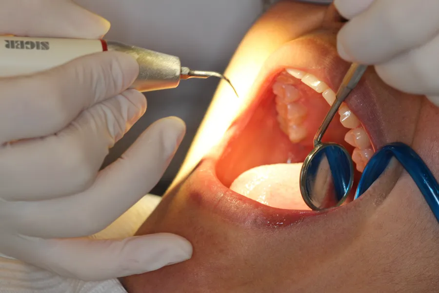 dientes-podridos-solución