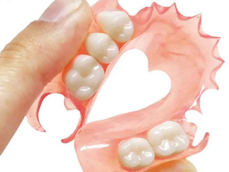 protesis-dental-removible-sin-metal