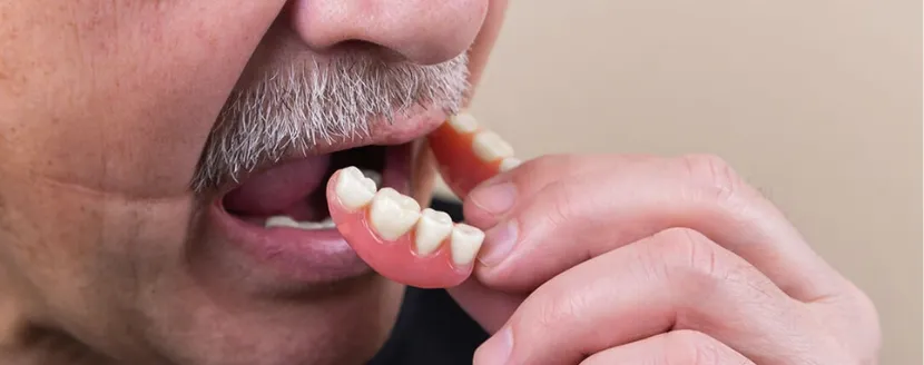 protesis-dental-removible-sin-metal