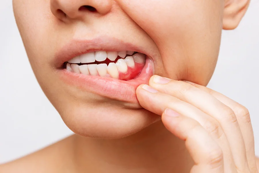 is it normal for teeth to move a little