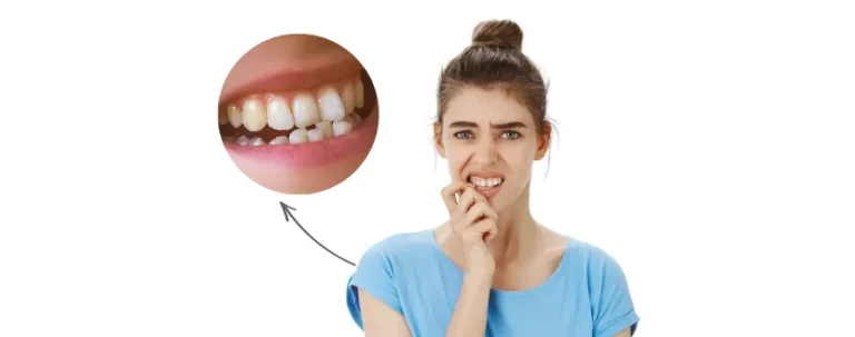 es normal que los dientes se mueven un poco