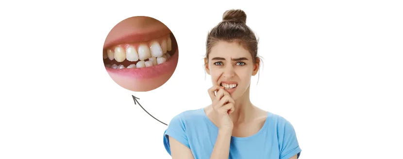 es normal que los dientes se mueven un poco