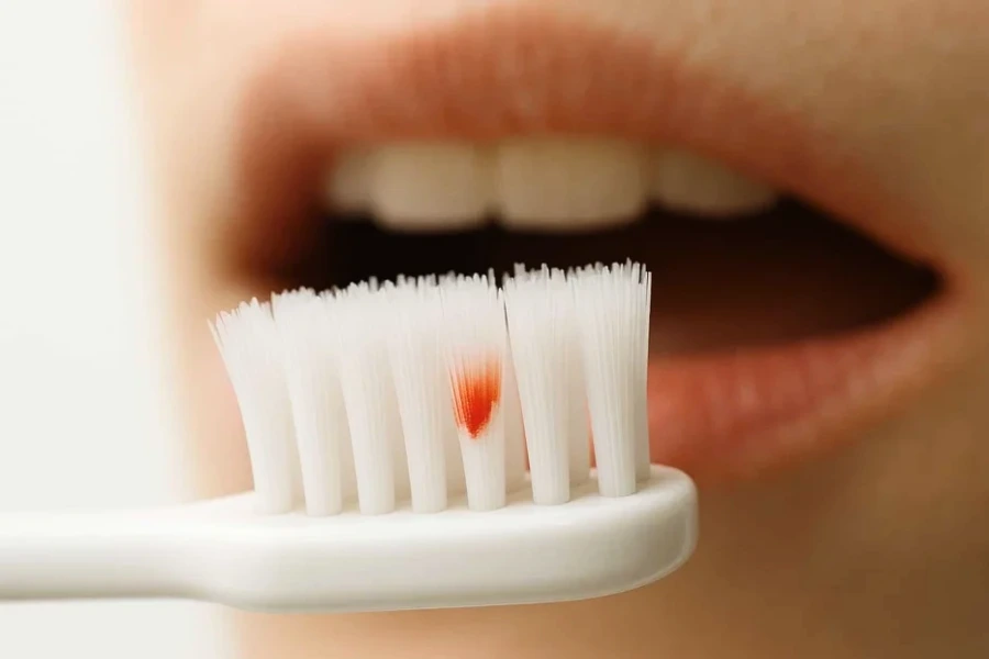bleeding gums